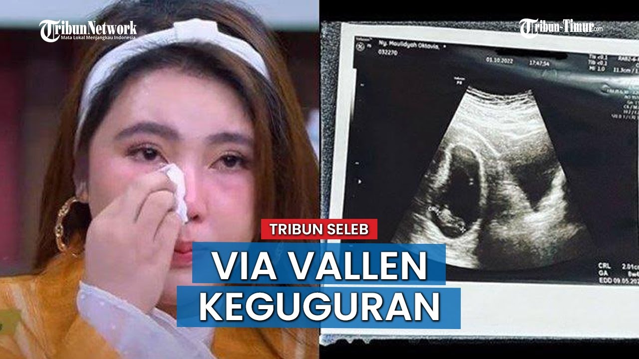 9 FAKTA Via Vallen Keguguran, Janin Tak Berkembang Selama 1 Bulan hingga Sempat Alami Nyeri Punggung