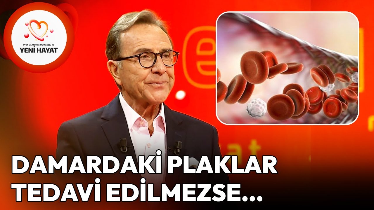 Damardaki Plaklar Tedavi Edilmezse Ne Olur? | Osman Müftüoğlu ile Yeni Hayat