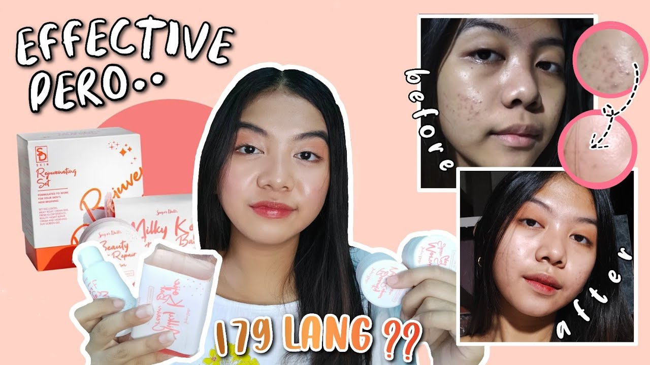 I TRIED THE SUGARDOLLS SKIN REJUVENATING SET FOR 1 MONTH! (BYE PIMPLES?)