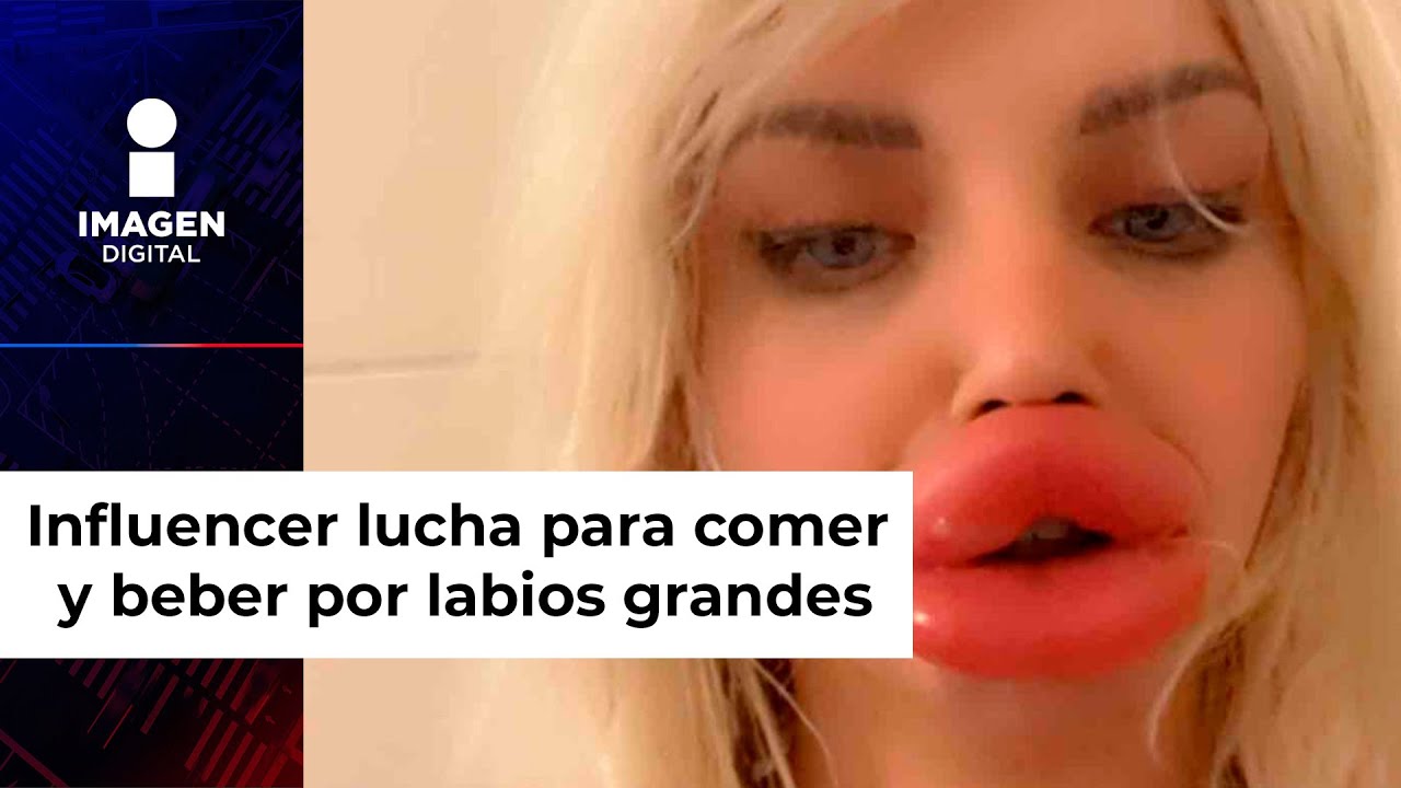 Influencer con enormes labios confiesa que ya no puede comer ni beber bien