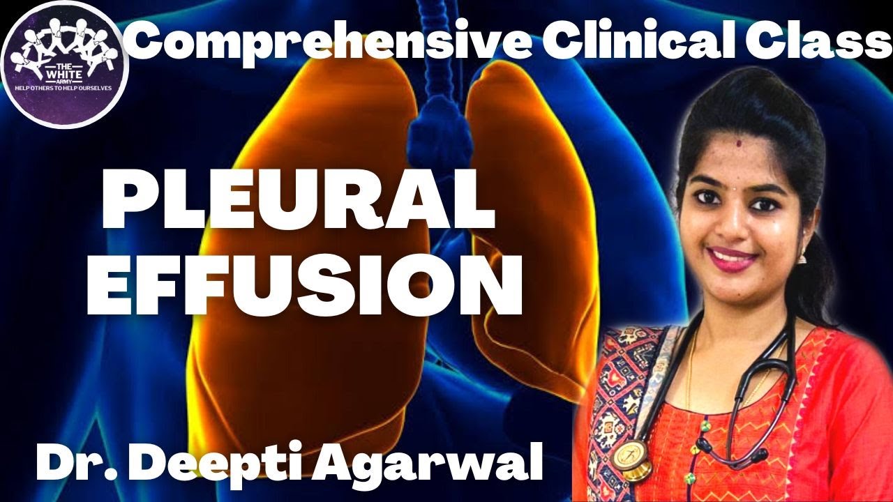 Pleural Effusion Clinical Case Presentation