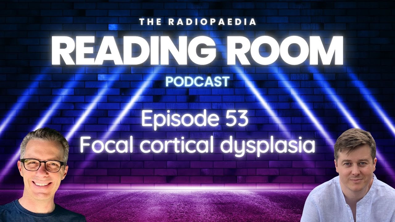 Focal cortical dysplasia