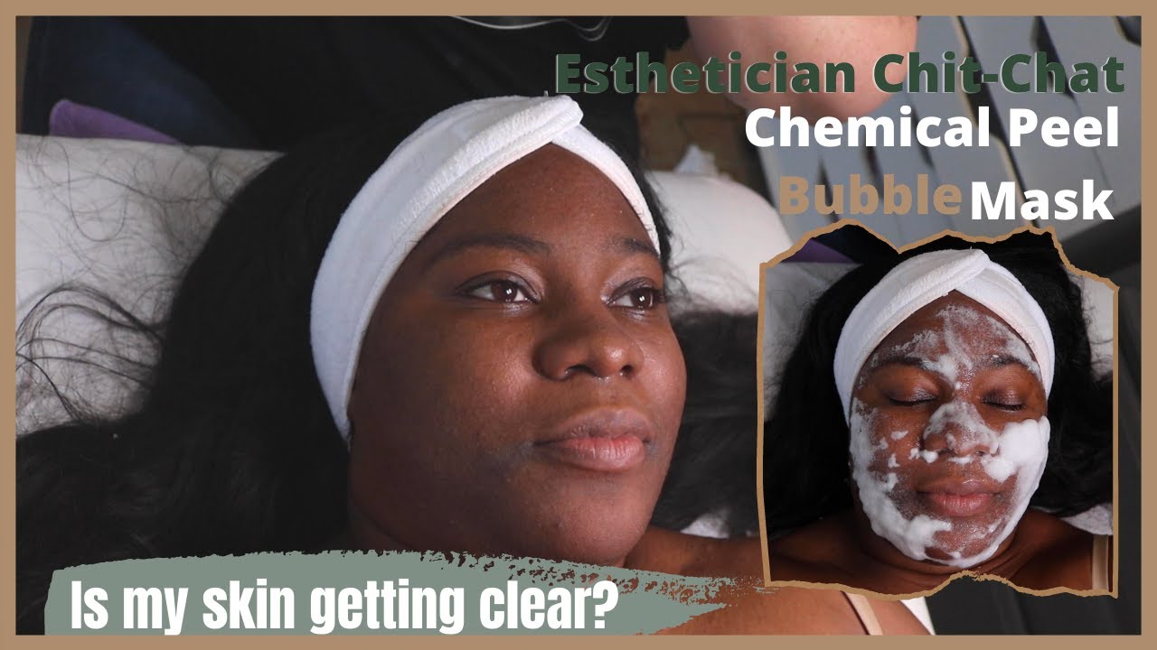 Getting a Chemical Peel |Esthetician Chat | Vera Jeanae