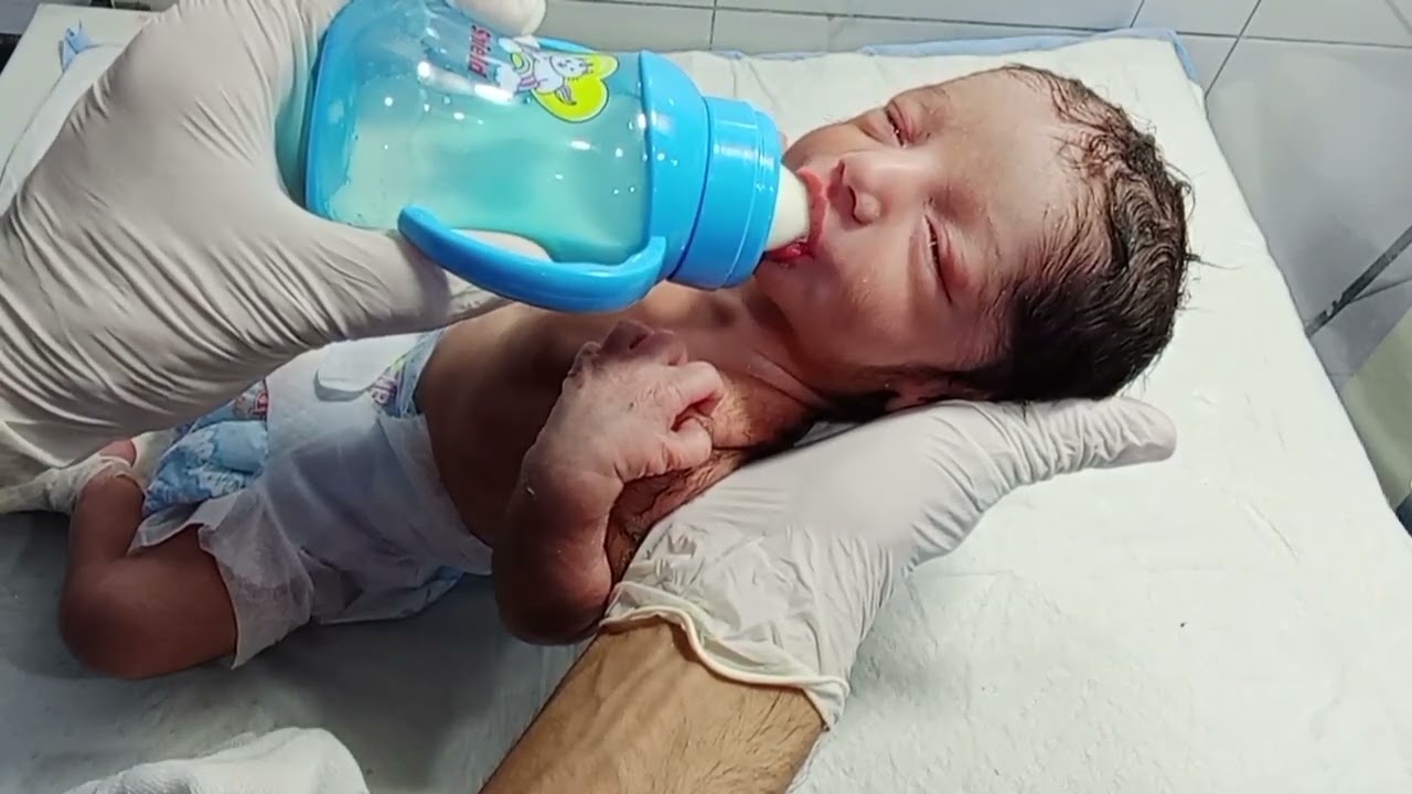 IUGR Baby in NICU | Treatment Care Management and First Feeding Trial