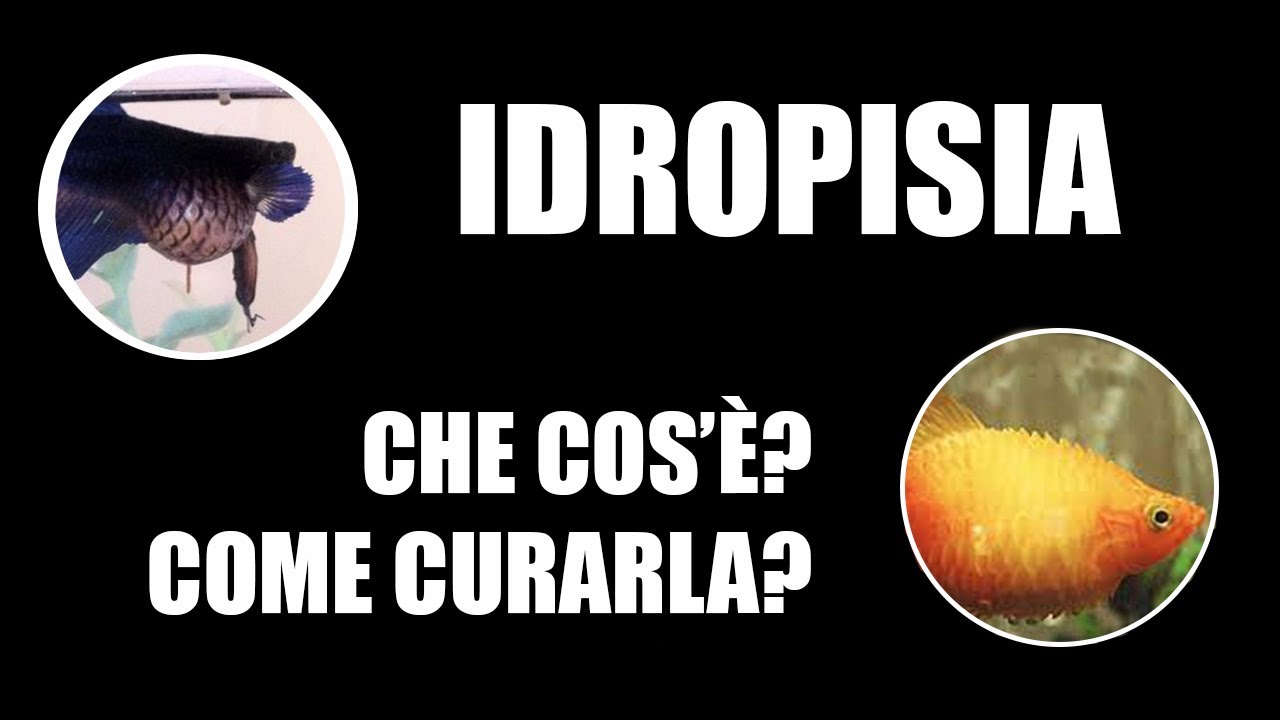 IDROPISIA. Che cos'è? Da cosa è causata?