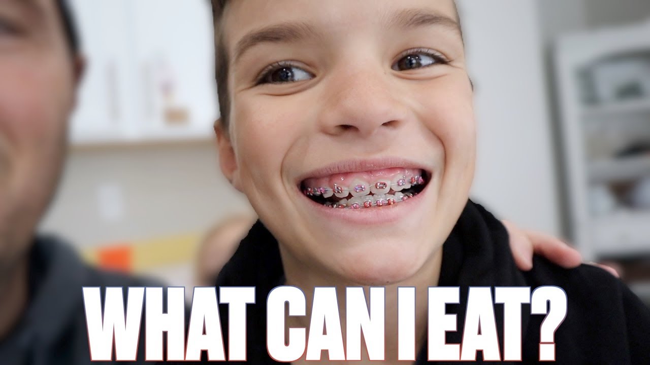 WHAT HURTS THE MOST GETTING BRACES FOR THE FIRST TIME | WHAT YOU CAN AND CAN'T EAT WITH NEW BRACES