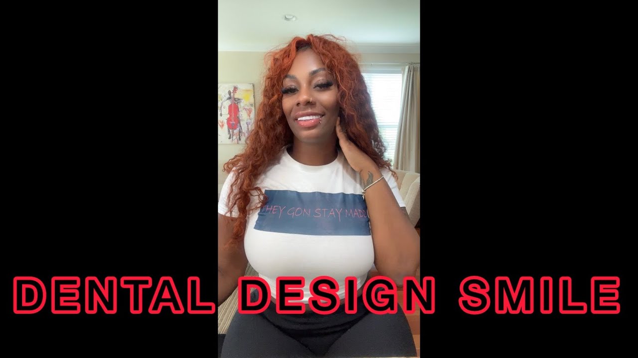 Implants And Veneers From Dental Design Smile Miami