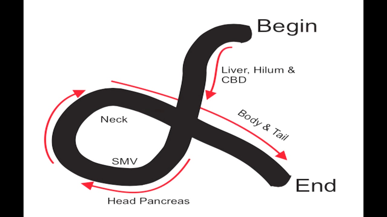Linear EUS Railroad Technique
