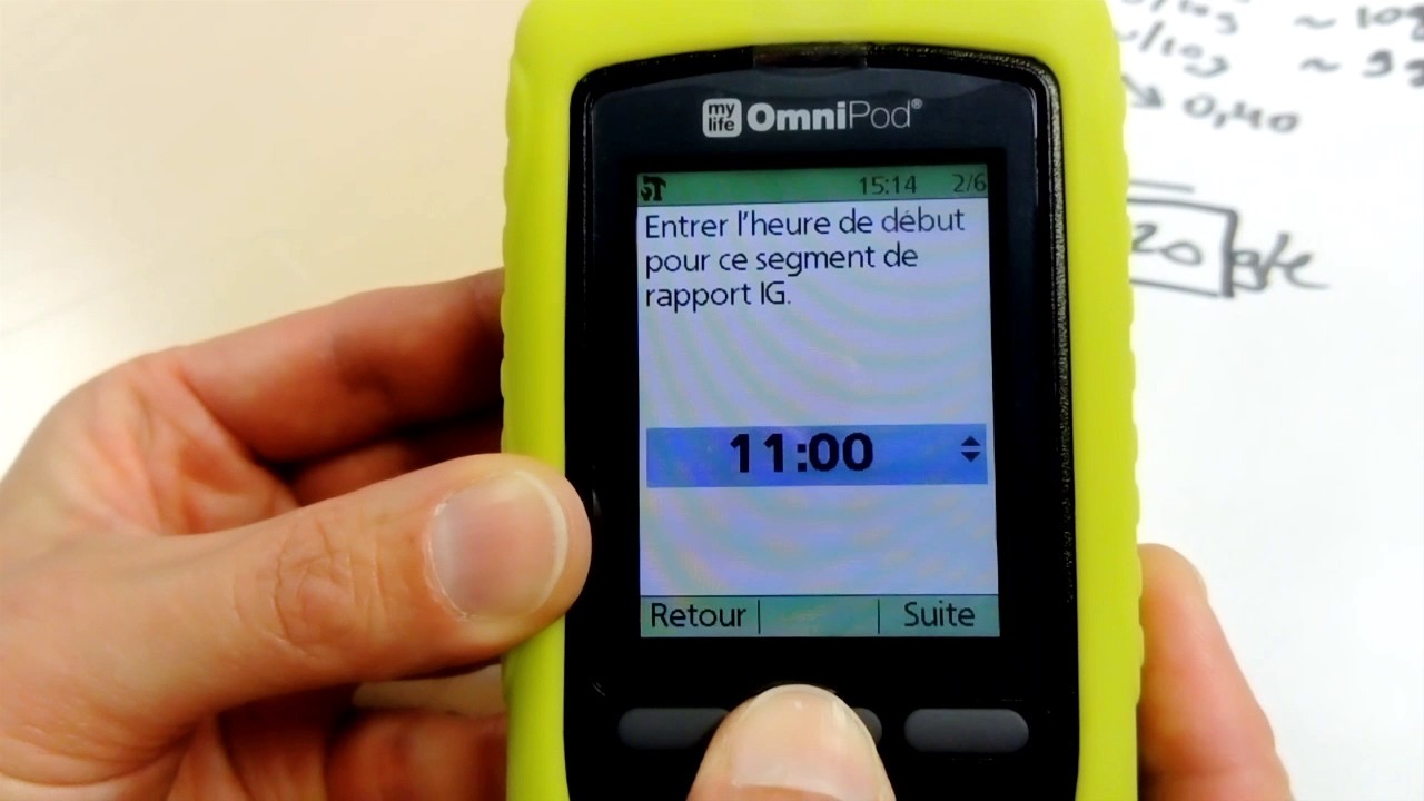 Réglage de l'assistant Bolus de la pompe Omnipod