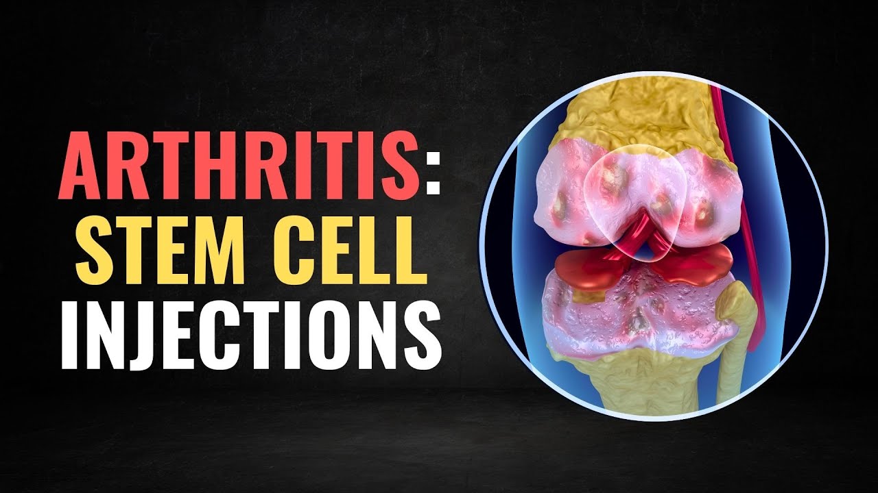 Stem Cell Injection for Knee Pain: You've Been Lied To