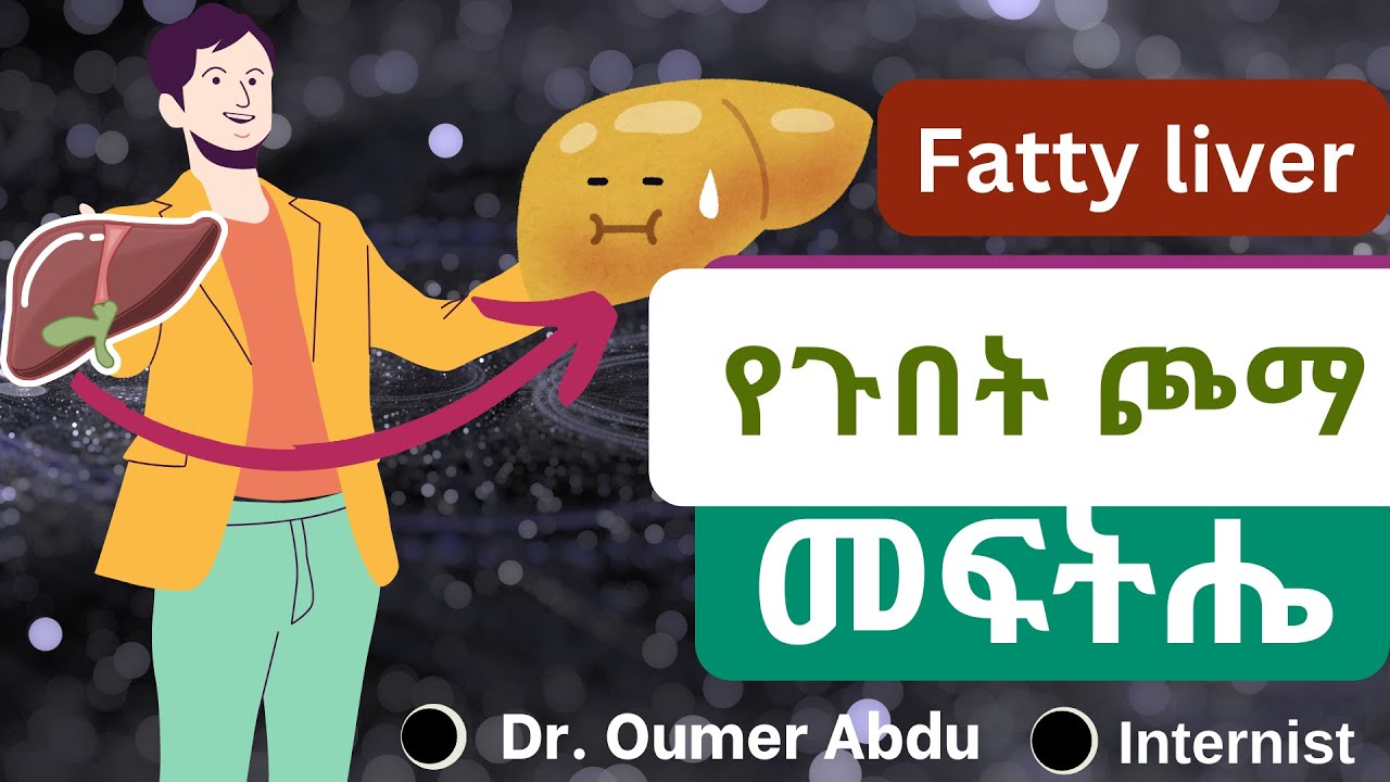 የጉበት ስብ እንዴት ይወገዳል? || how can we get rid of fatty liver ||Beles