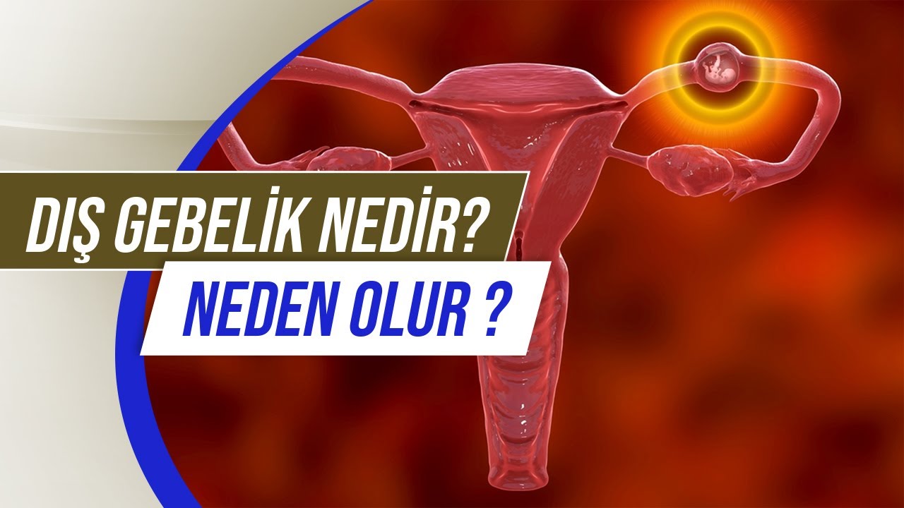Dış Gebelik Nedir? Dış Gebelik Kaçıncı Haftada Olur? Dış Gebelik Belirtileri - Doç. Dr. Aydın Köşüş