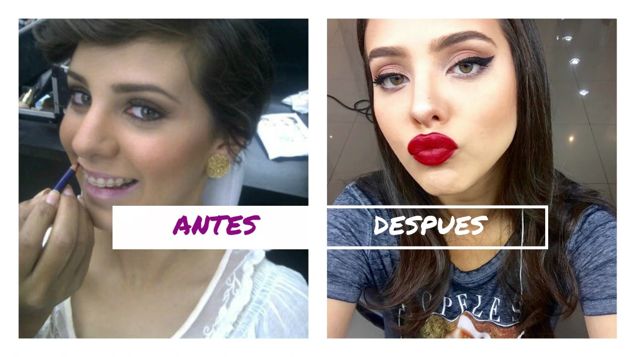 MI EXPERIENCIA CON LA RINOPLASTIA - STORY TIME