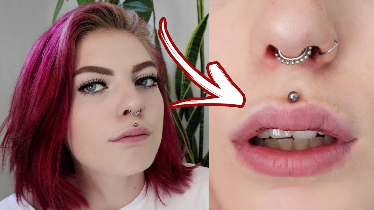 SUPER SWOLEN LIP | healing process medusa/philtrum piercing