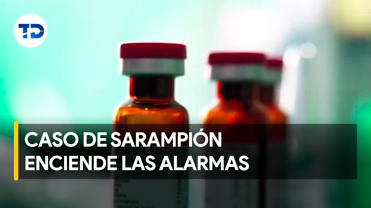 Activan vigilancia epidemiológica tras caso de sarampión
