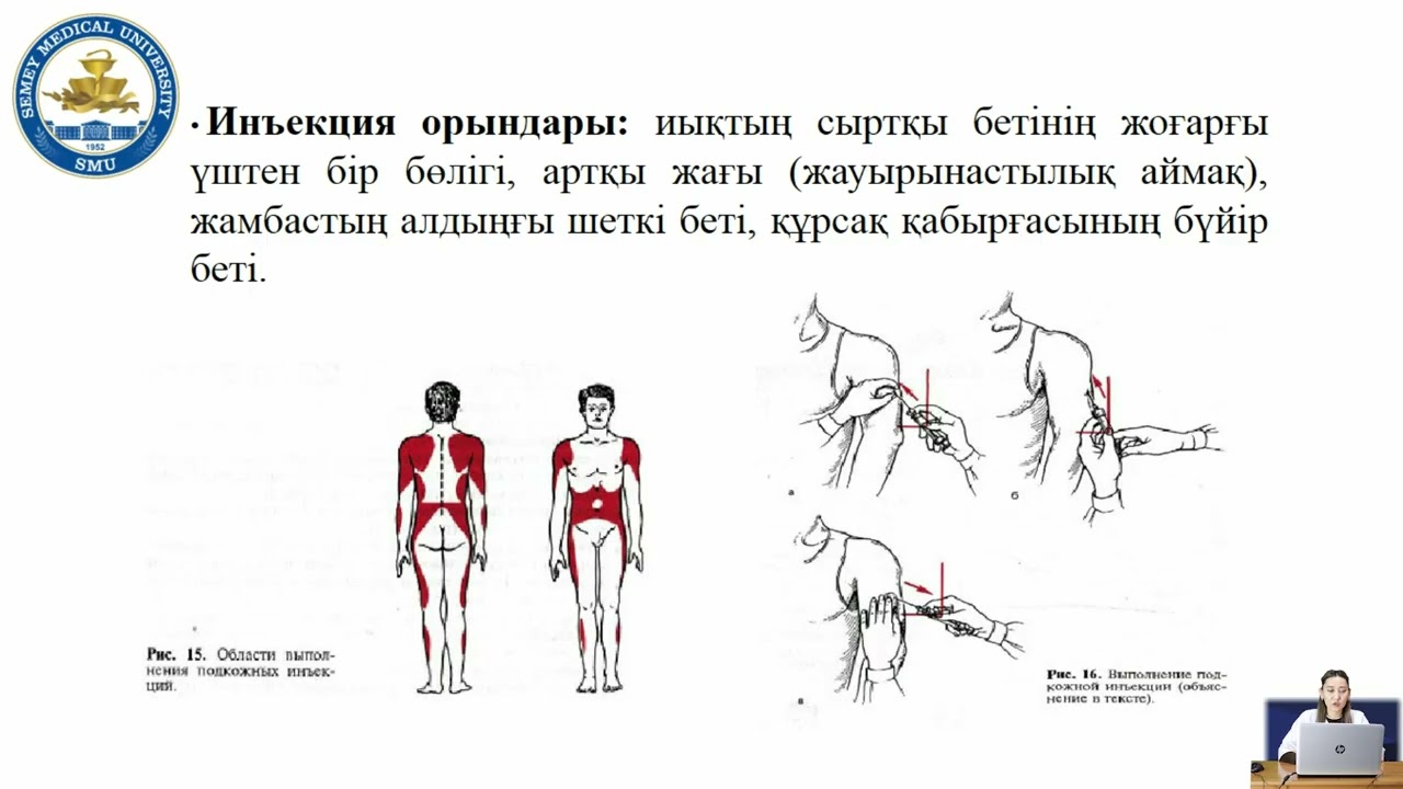 Парентальды дәрілік заттарды  енгізу жолдары