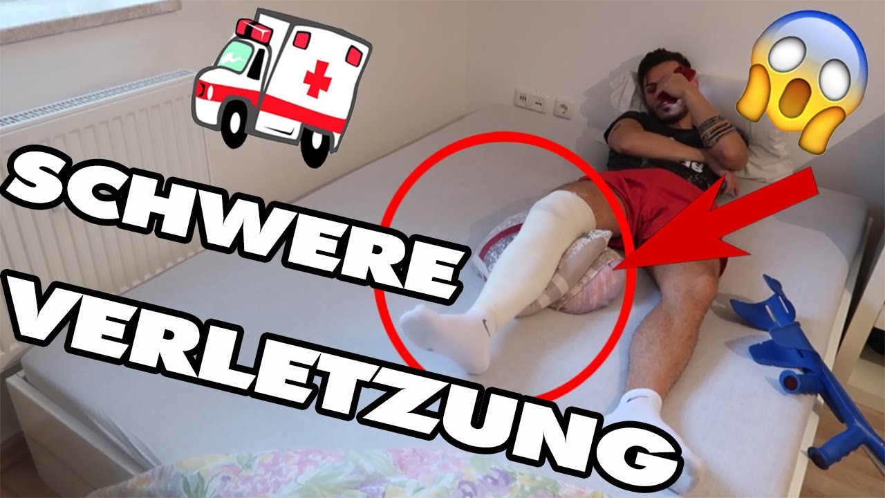 SCHWERE VERLETZUNG - OMG! WAS NUN ?! | daily VLOG TBATB