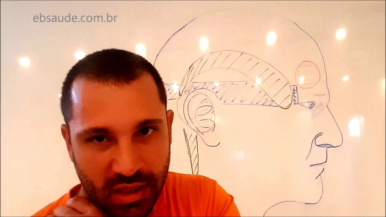 Dor de cabeça e Dry Needling