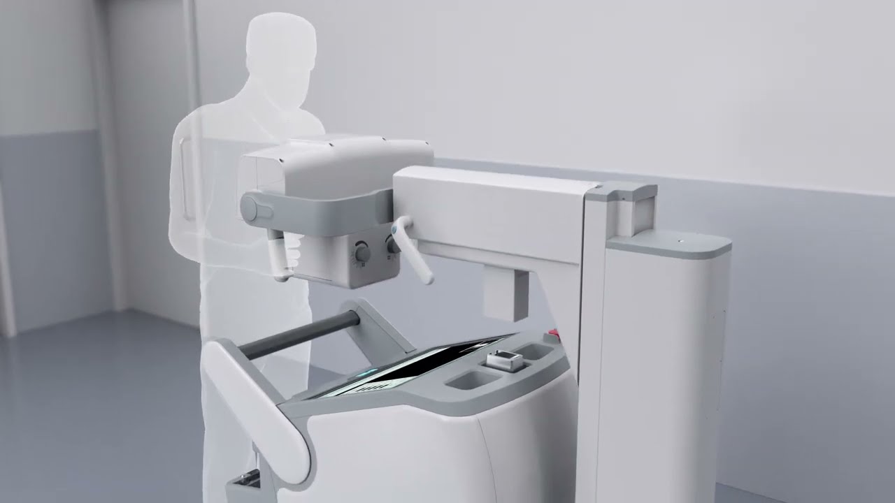 Mobile X-ray System—MobileGenius Product Video
