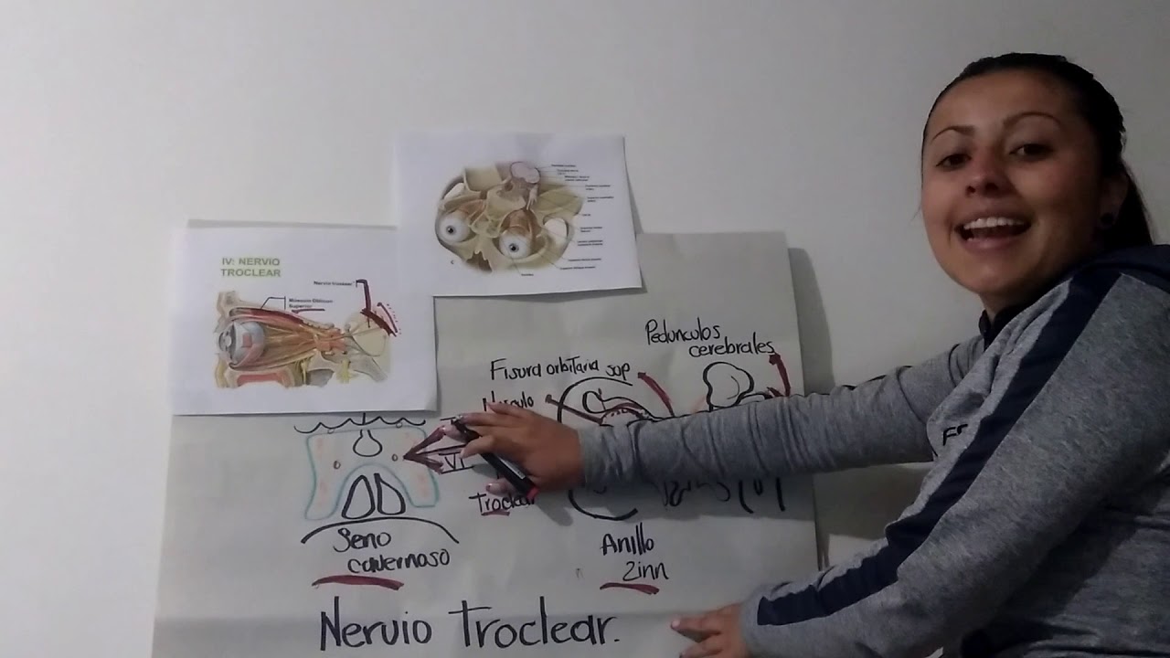 Trayectoria Del Nervio Troclear