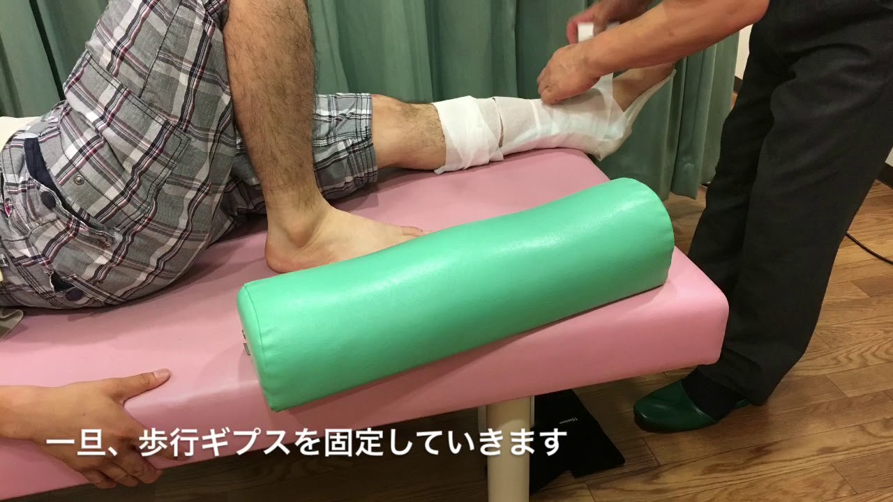 アキレス腱断裂歩行療法事例 保存療法のギプス固定二週間後に歩行療法切り替え