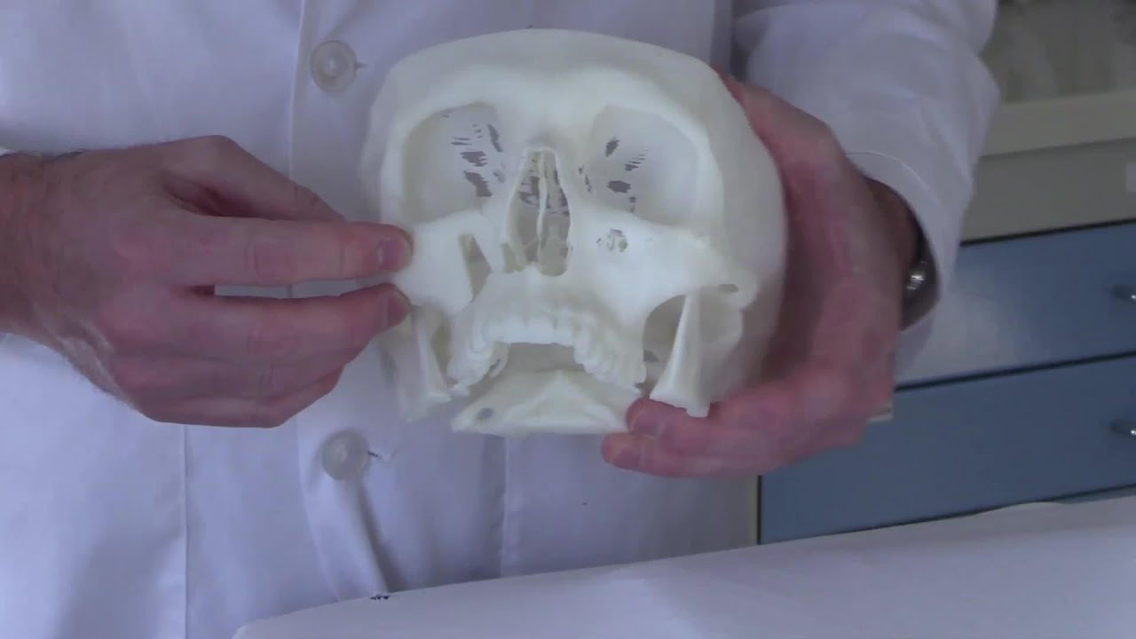 How 3d modelling enabled rebuilding of patient's face