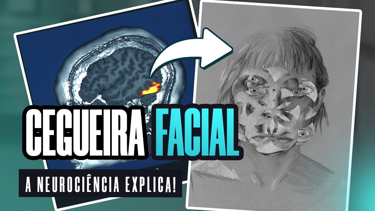 CEGUEIRA FACIAL: descubra a PROSOPAGNOSIA!