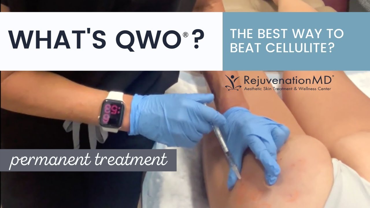 What is QWO? Is This the Best Cellulite Treatment Ever?