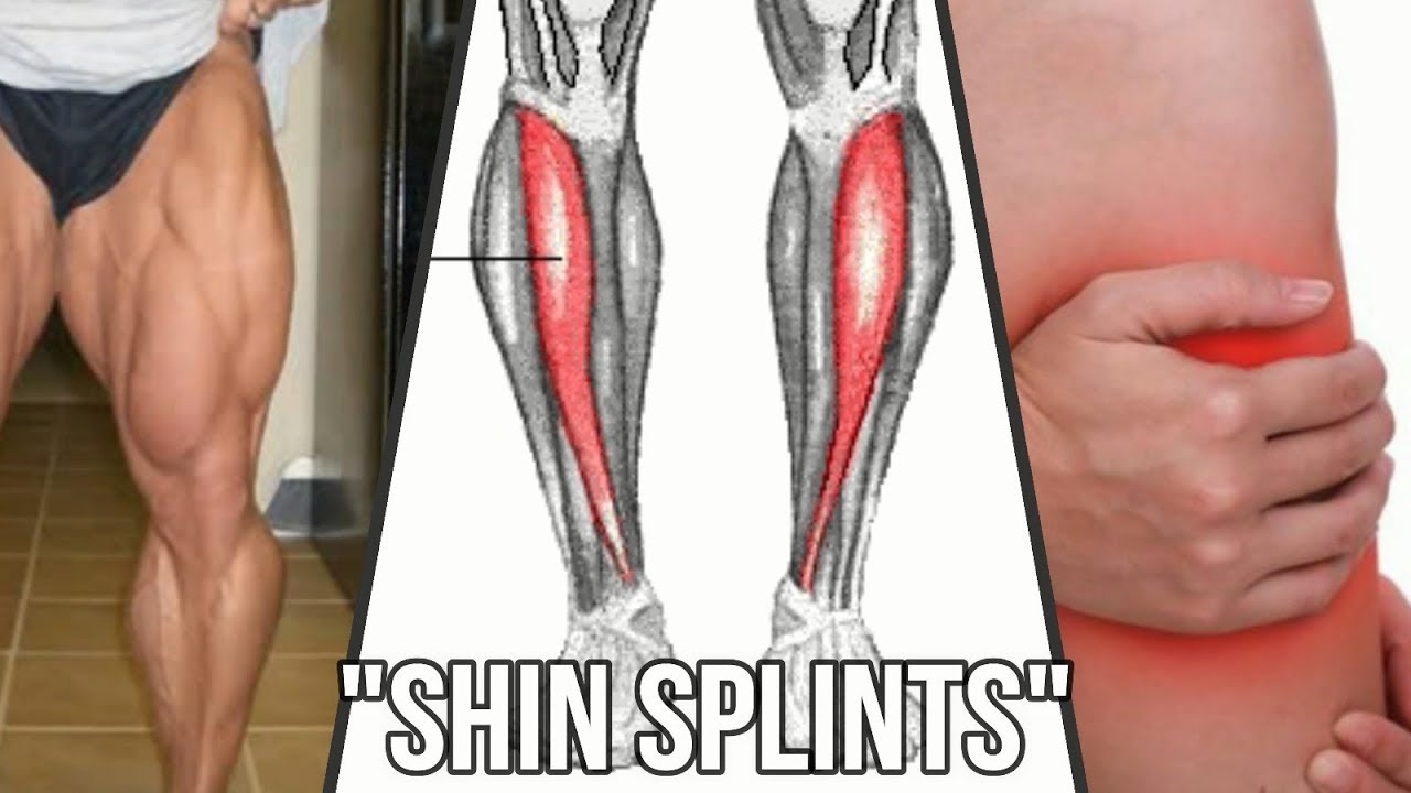 Mięsień piszczelowy przedni + SHIN SPLINTS - Zapomniane mięśnie #6