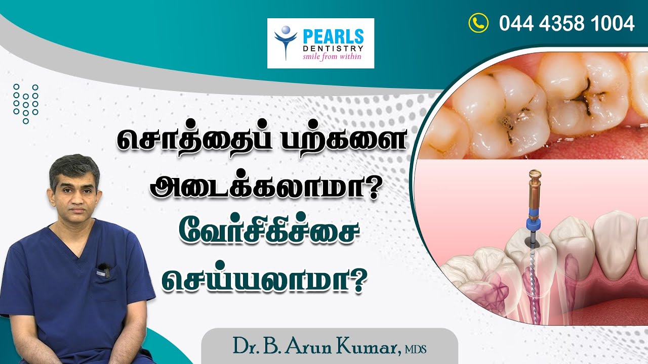 Is it good to Seal teeth....? Is Root Canal safe...? - Pearls Dentistry..-Dr.Arunkumar