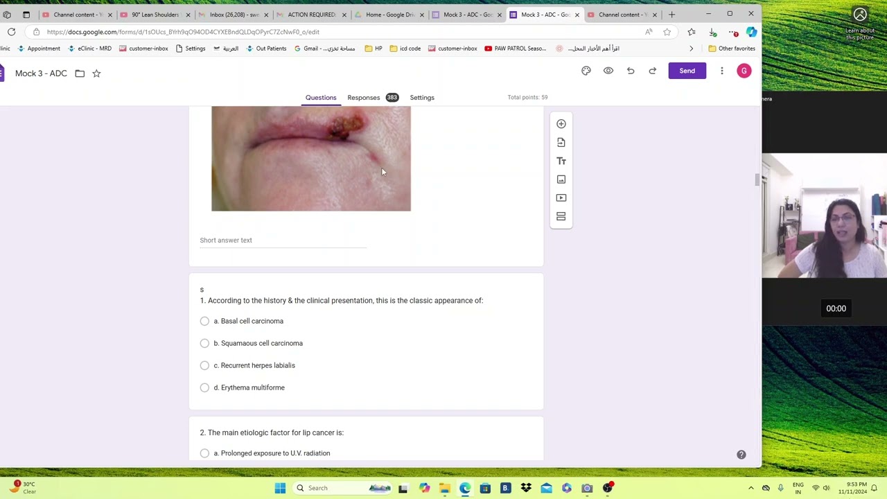 Squamous cell carcinoma and ADC questions