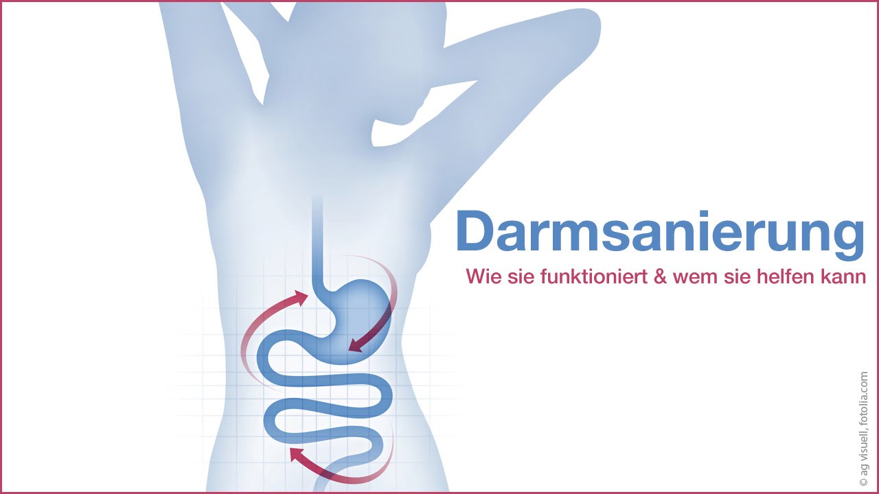 Darmsanierung - Wie sie funktioniert & wem sie helfen kann