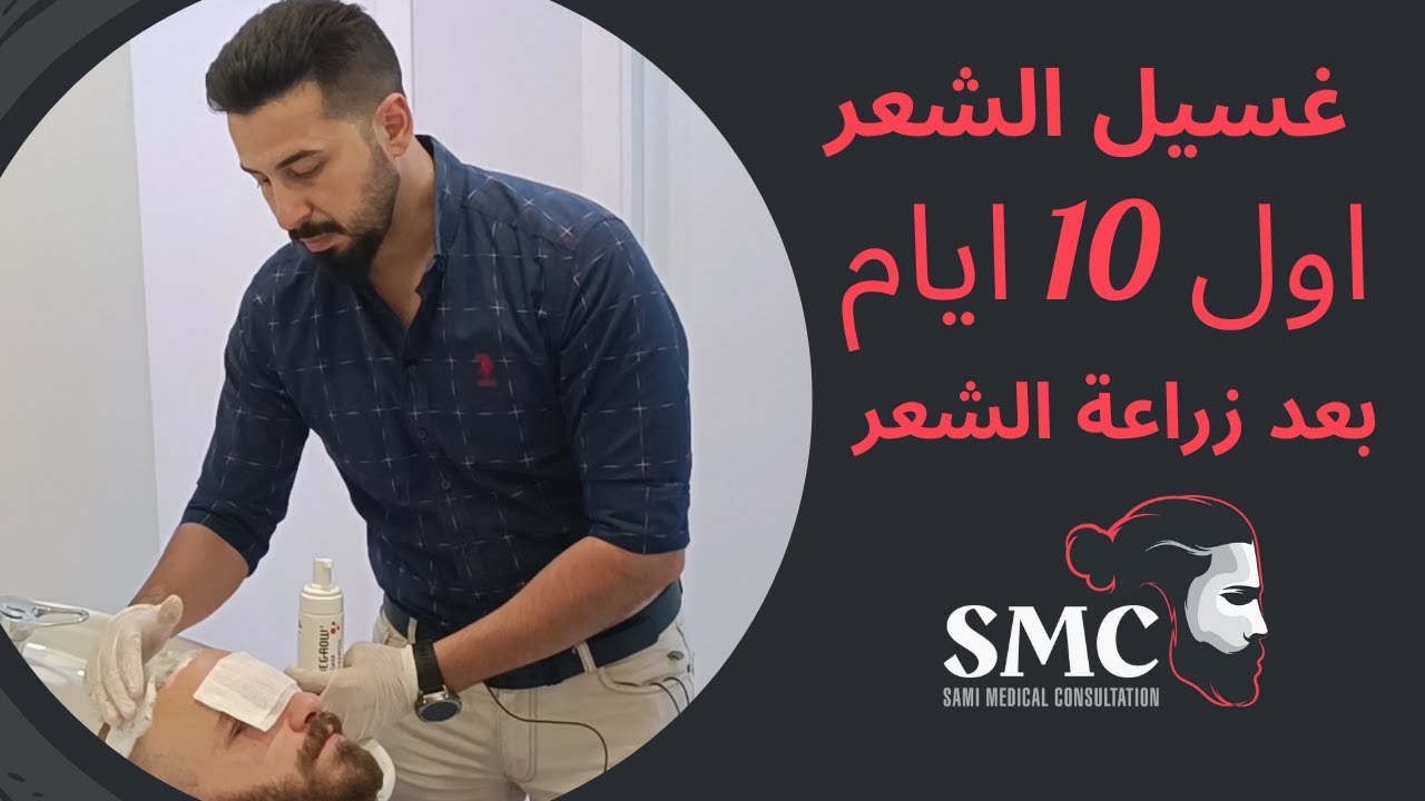 طريقة غسيل الشعر اول 10 ايام بعد عملية الزراعة _المستشار سامي_