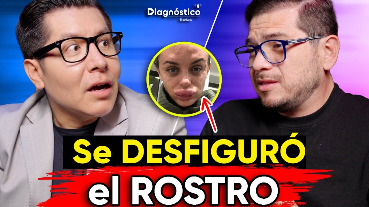 😱¡TERRIBLE! Las PEORES CIRUGÍAS PLÁSTICAS de FAMOSOS | #Diagnóstico 129 | Mr Doctor