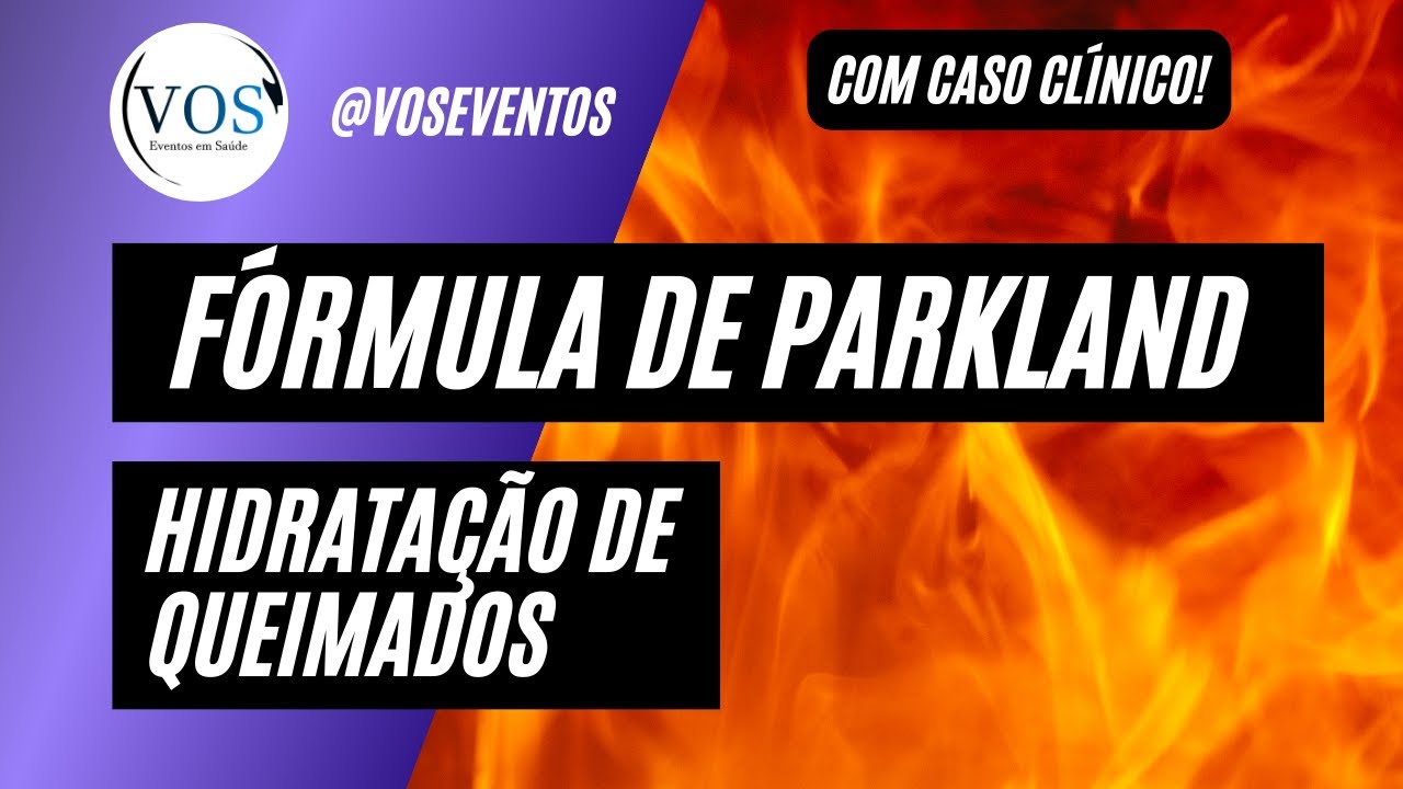 Fórmula de Parkland: hidratação de pacientes queimados.