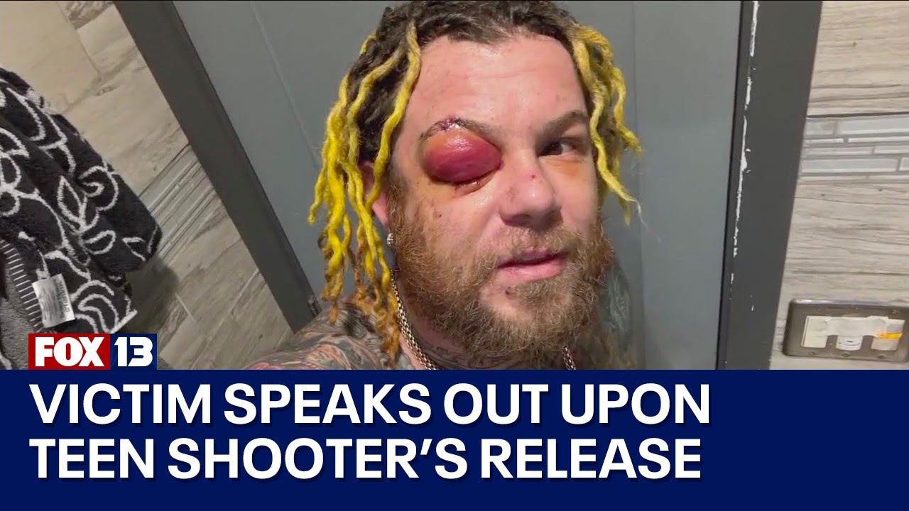 Teen shooting suspect released, victim speaks out | FOX 13 Seattle