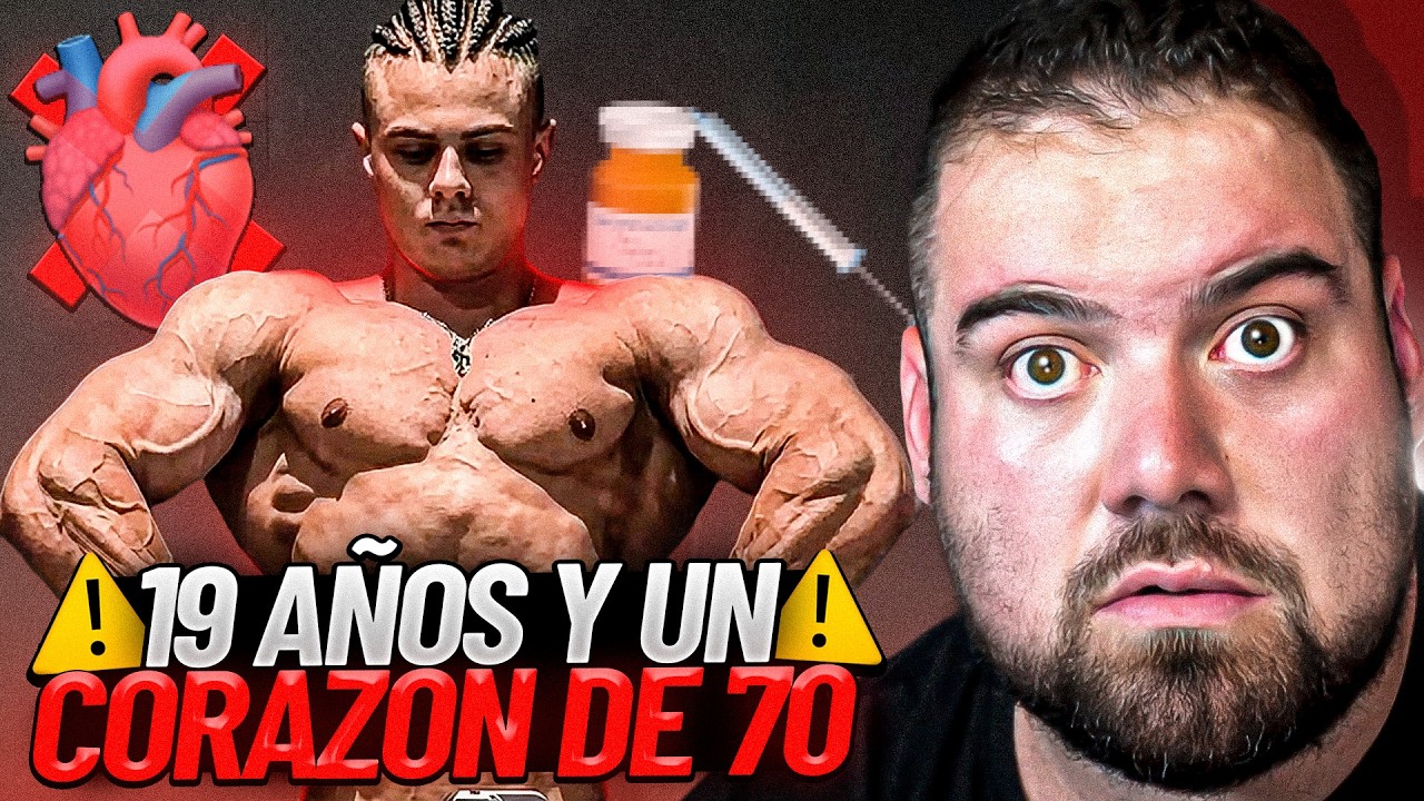 TIENE 19 AÑOS Y CORAZÓN DE 70 POR USAR QUÍMICA 