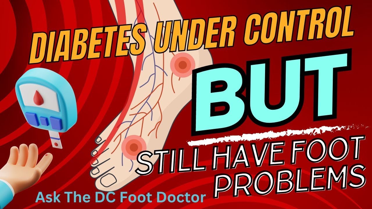 Diabetes Is Well Controlled, But Still Have Foot Problems