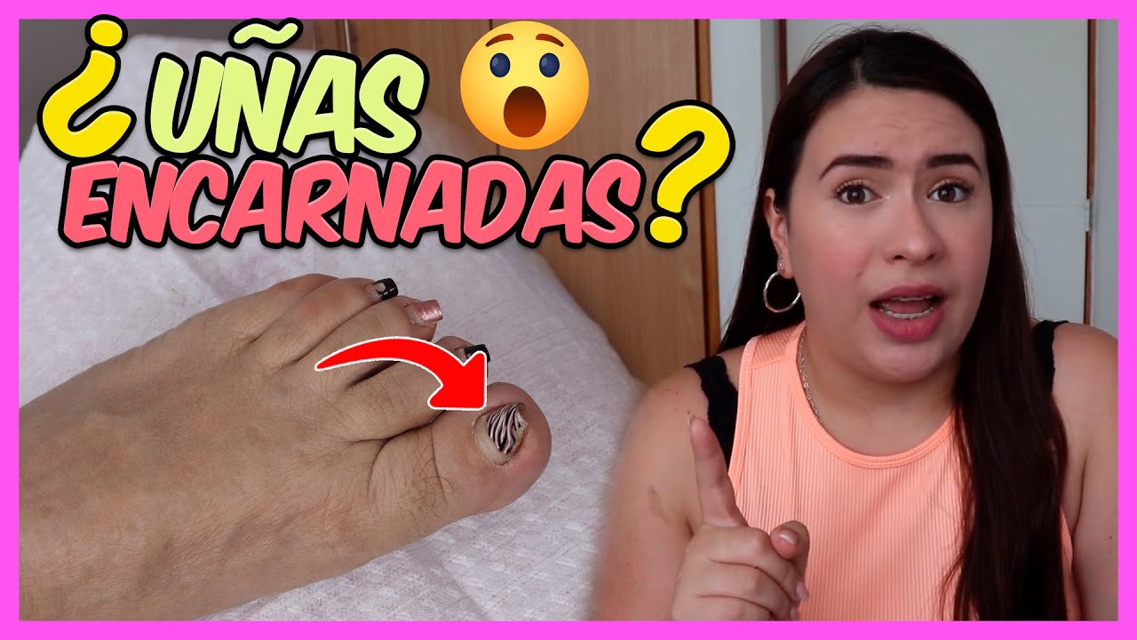 ¿Cómo SACAR una UÑA ENCARNADA? HÁZLO como PROFESIONAL ✅ - Curso De Uñas 
