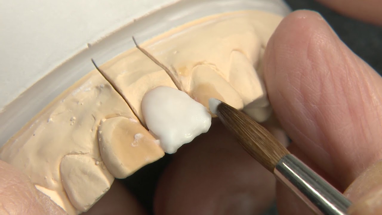 Die Build-up-Technik von Hitoshi Aoshima