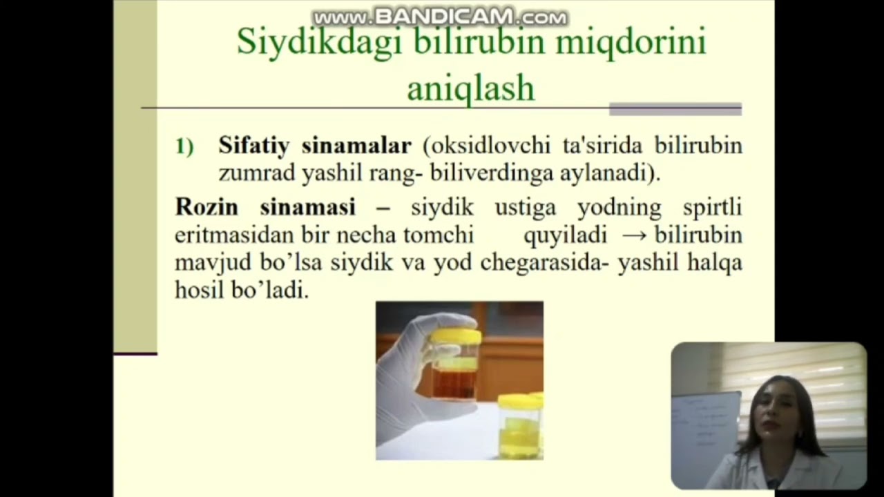 Bilirubin almashinuvi va tekshiruv usullari
