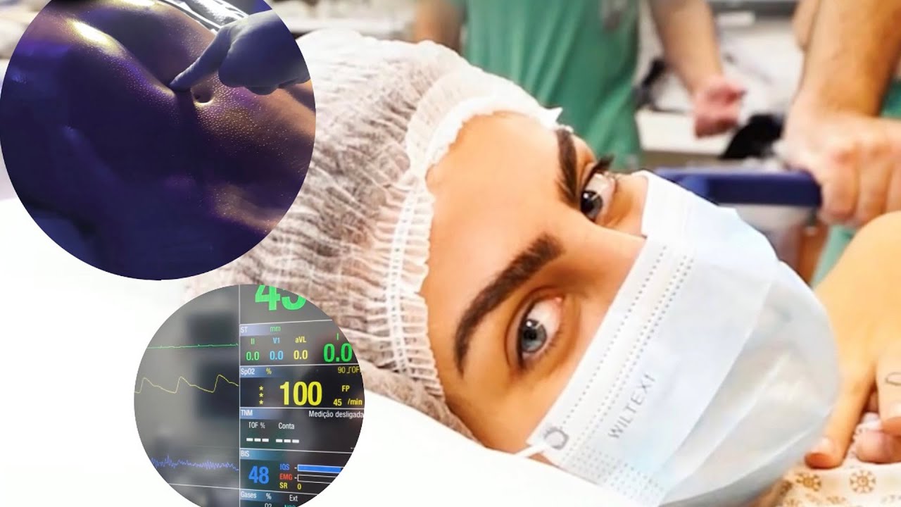 FIZ UMA LIPO LAD!!
