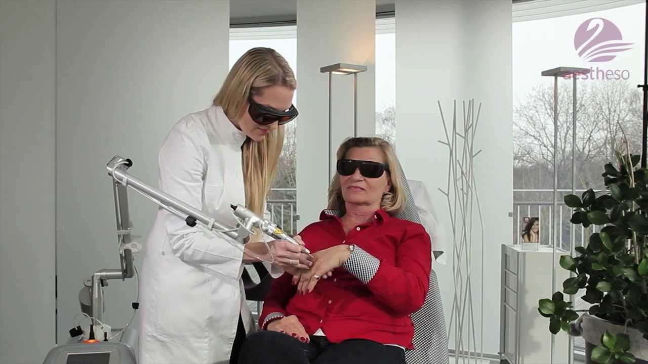 Laserbehandlung bei Pigment und Altersflecken - Dr. med. Nadine Peukert