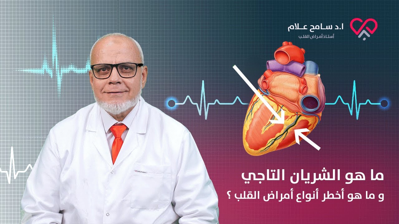ما هو الشريان التاجي و ما هو أخطر أنواع أمراض القلب ؟ دكتور سامح علام