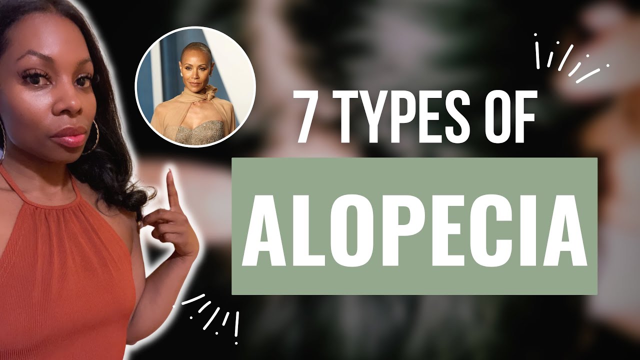 The Different Types of Alopecia: What You Need to Know! (Watch This for More Information!)