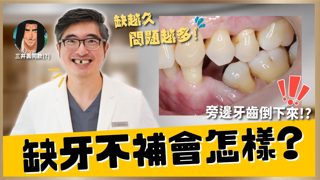 【植牙 #13】專家揭密：缺牙不補，居然會造成這些無法挽回的口腔問題！你一定沒想到的後果！這些問題越拖越危險！｜【祐民牙醫－隱適美旗艦店】鑽石級楊大為醫師 #缺牙 #植牙 #補牙 #牙橋 #假牙