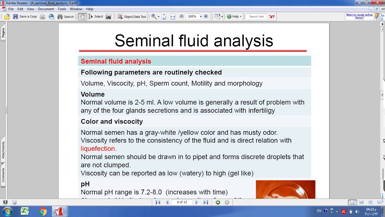 المحاضرة 4  seminal fluid analysis