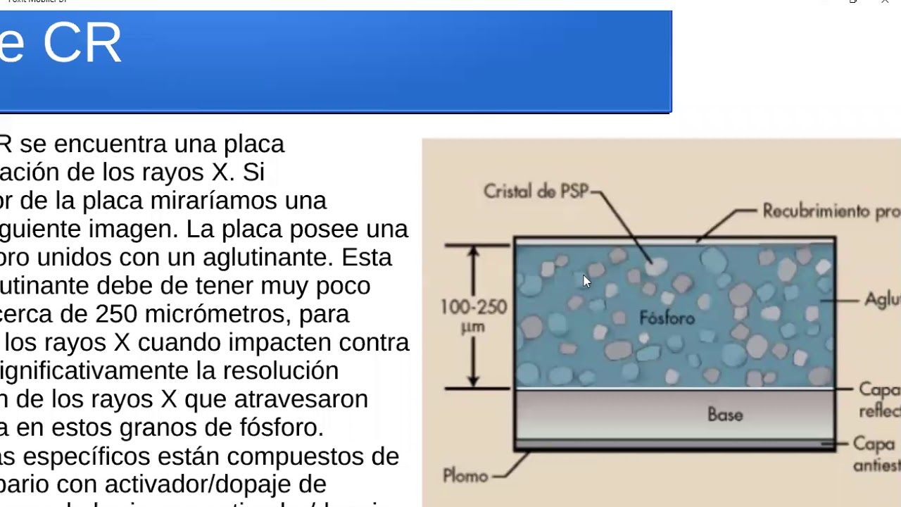 Radiografía Computarizada parte 1