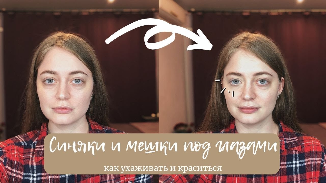 Как скрыть и закрасить синяки и мешки под глазами: пошаговый видео-урок