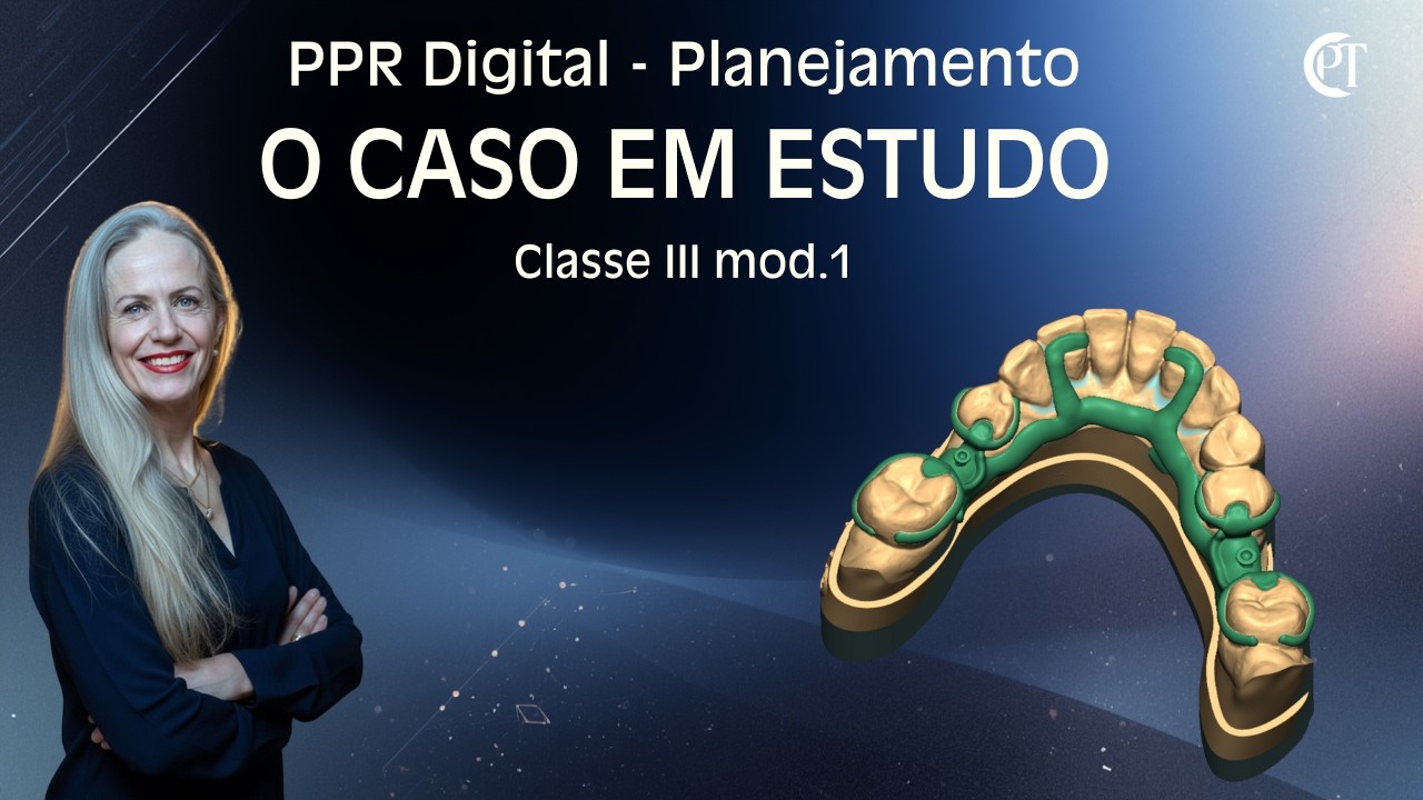 ⭐ DELINEAMENTO VIRTUAL -  DETERMINAÇÃO DO PLANO DE INSERÇÃO -   PT